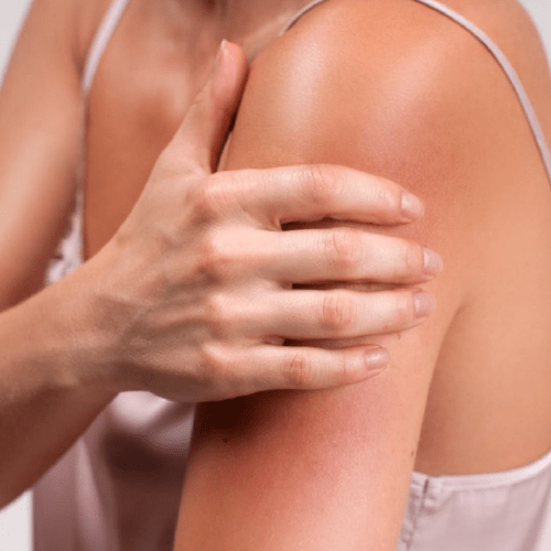 Reductores de irritación